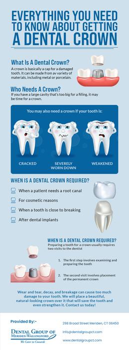Restore Your Broken Tooth from Dental Crowns Dentist in Meriden, CT at Dental Group of Meriden-Wallingford